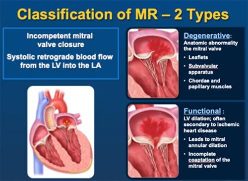 Two classifications of MR