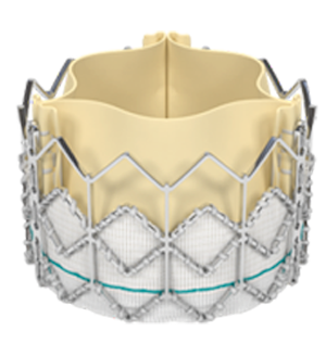 tavr-procedure-lg